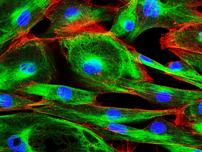 AOTF在共聚焦顯微鏡中的應用和優勢